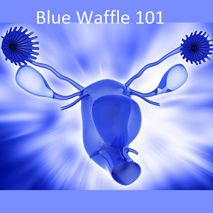 blue waffle disease in men